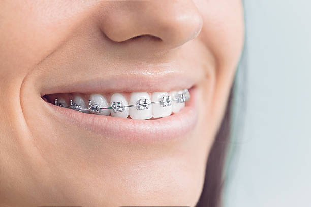 Best Full Mouth Reconstruction  in Lavonia, GA